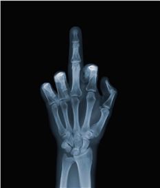 Nick Veasey (British, 1962)