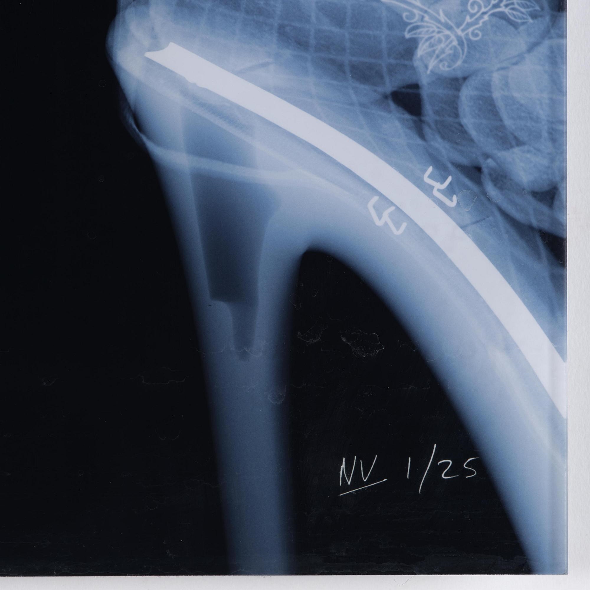 Artwork by Nick Veasey, Stripper, Made of C-print mounted on glass