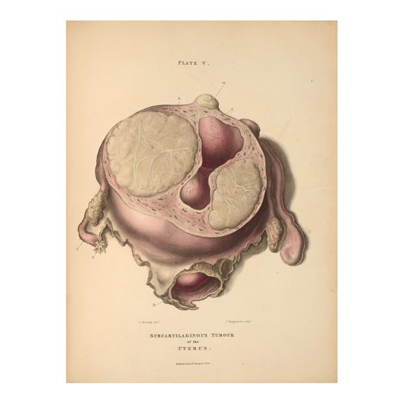 Mr. Hooper | The Morbid Anatomy of the Human Uterus and its Appendages ...