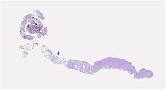 On a Tongue’s Tip, at a World’s Lip - Kunstraum Niederoesterreich 