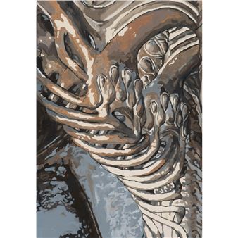 Spina Bifida - Isabella Ogeda