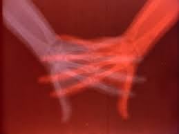 Overexposed: Art, Technology, and the Body