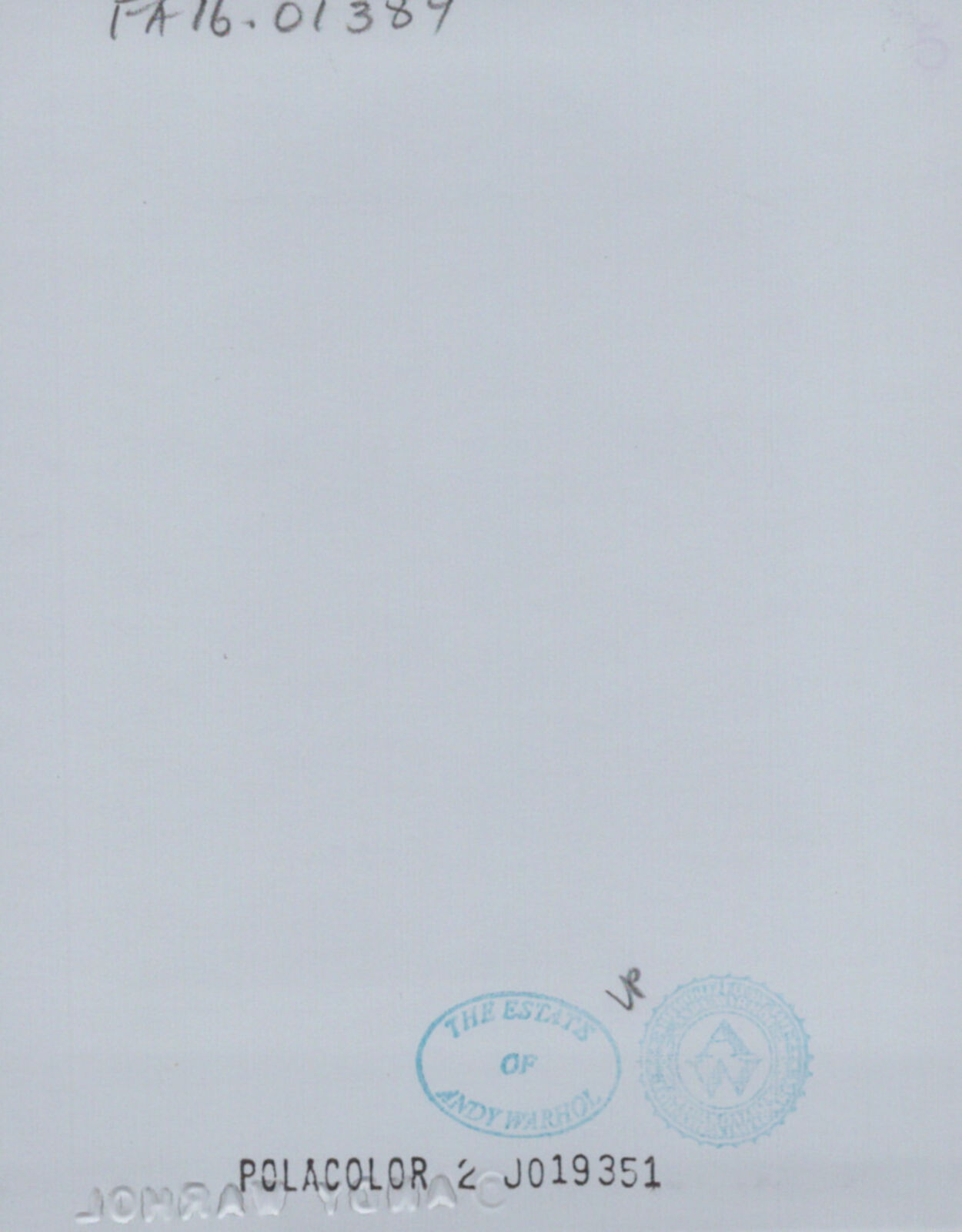 A polaroid photo of a woman's butt before and after a tummy tuck.