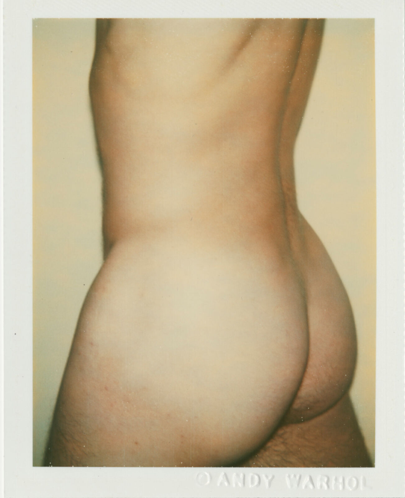 A polaroid photo of a woman's butt before and after a tummy tuck.