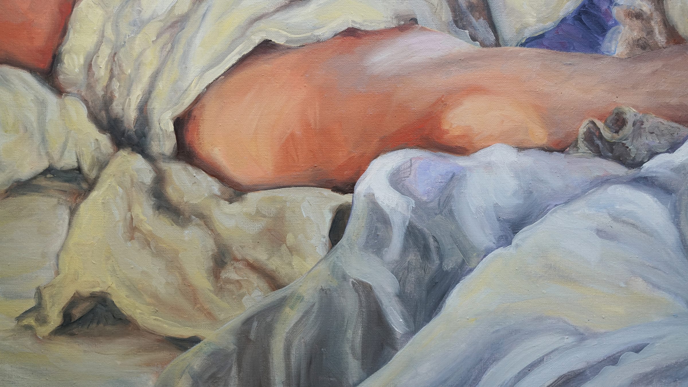 A painting of a man laying in bed with a towel on his head.